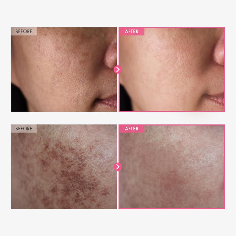 Before and after appearance comparison