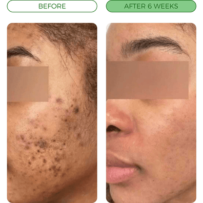 Turmeric Fade & Glow Cleansing Bar for Dark Spots — Face & Body