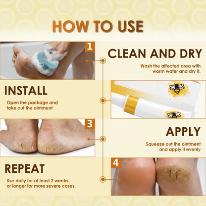Wart, Corn & Callus Relief Cream — Targeted Daily Care for Rough, Hardened-Looking Skin on Hands & Feet