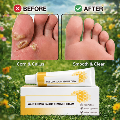 Wart, Corn & Callus Relief Cream — Targeted Daily Care for Rough, Hardened-Looking Skin on Hands & Feet